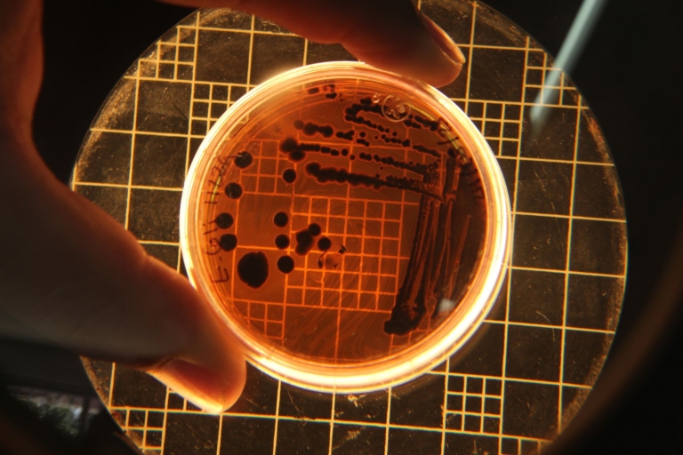 Bakterilerdeki Evrimsel Süreçler Yeni Antibiyotikler Üretebilir